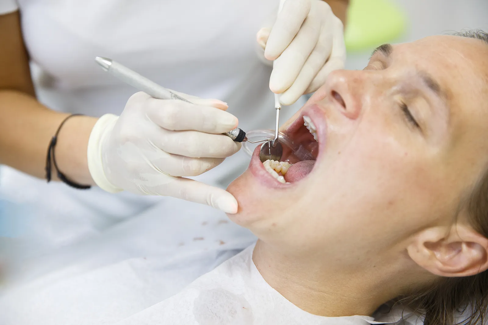 Unlocking the Secrets of Preventative Dentistry: Why Routine Cleanings Matter