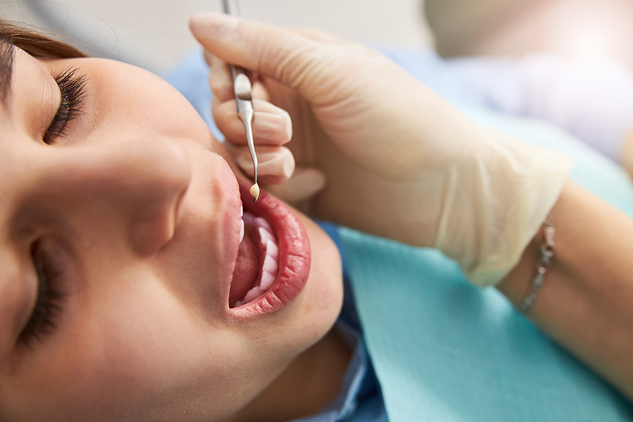 The Science Behind Root Canal Therapy